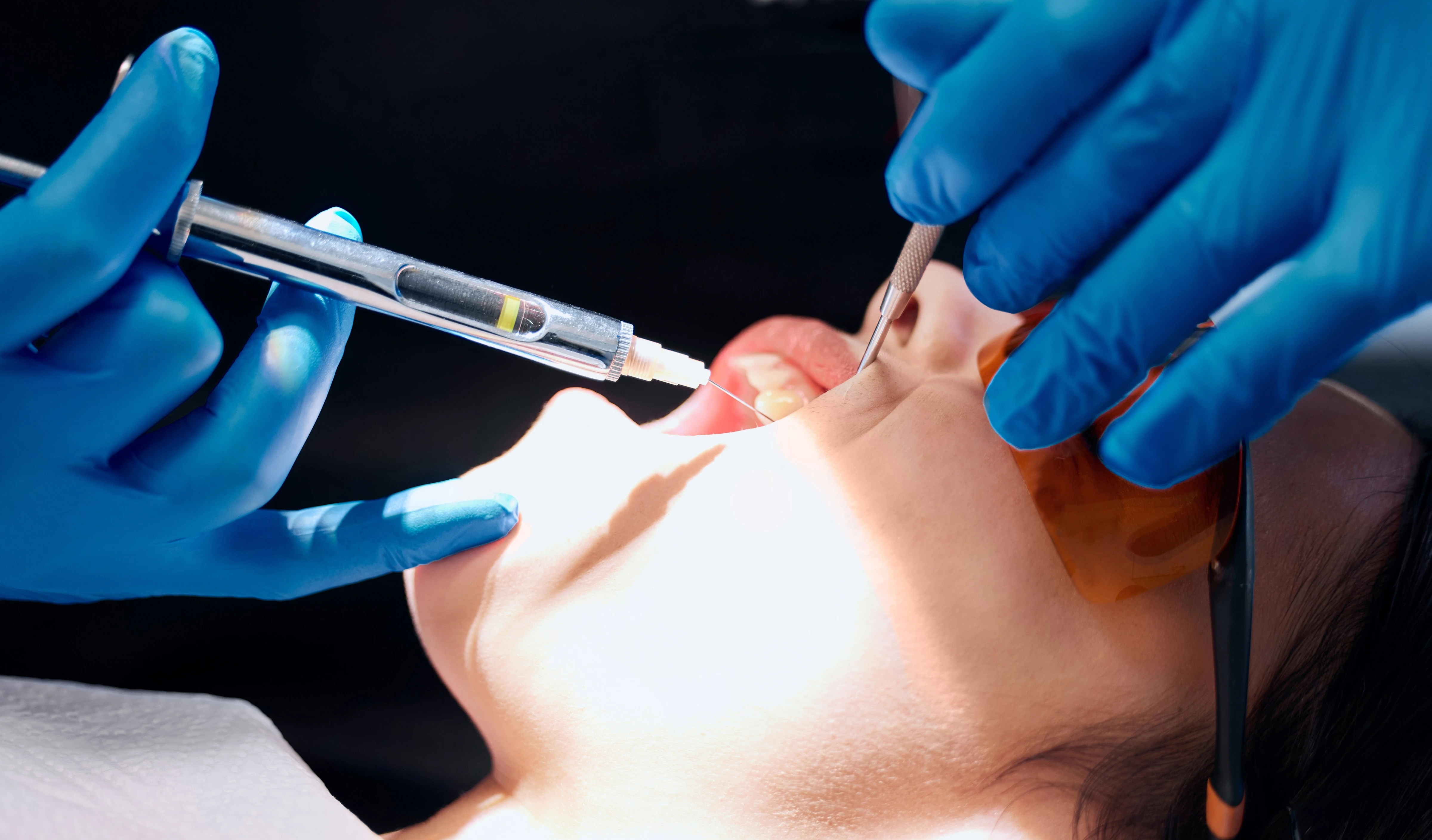 Dermal Fillers